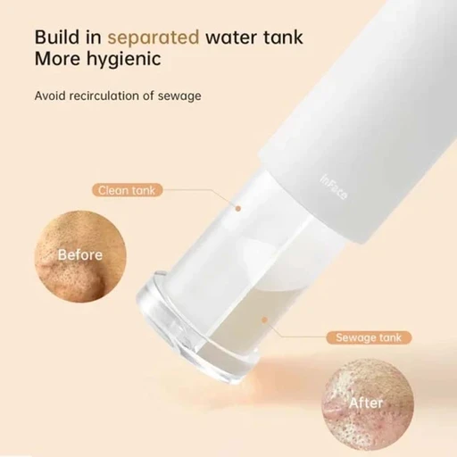 دستگاه پاکسازی صورت (میکرودرم) شیائومی مدل Inface Thermal Aqua Peel Facial Device CF-07E